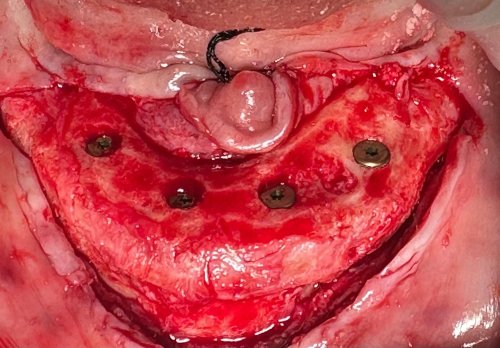 Carousel post from tersaoafs.