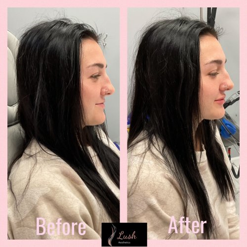 Photo post from lushaestheticsky.