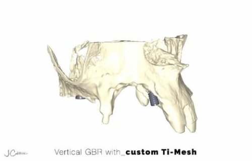 Carousel post from j.calatrava_dds.