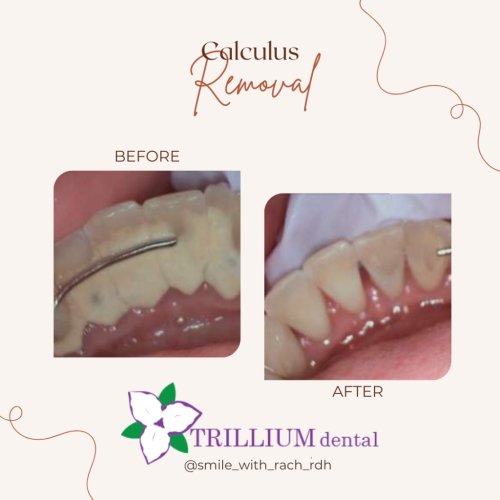 Photo post from trilliumdental.