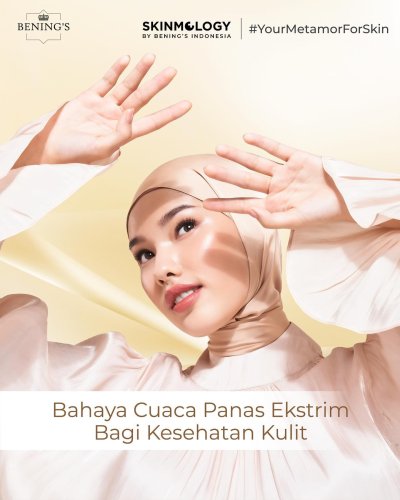 PostPhoto