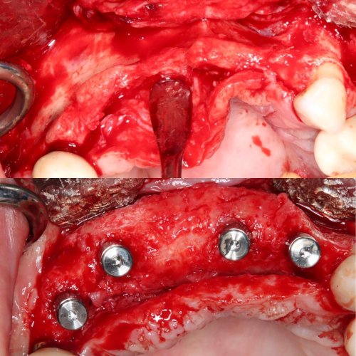 Carousel post from thefaceguys.