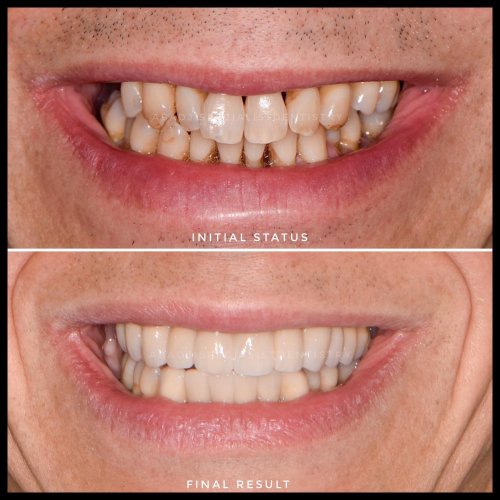 Carousel post from abadjispecialistdentistry.