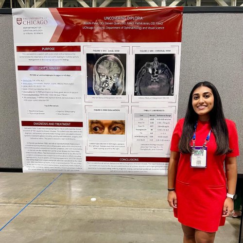 Carousel post from uchicagooptom.