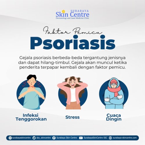 PostPhoto