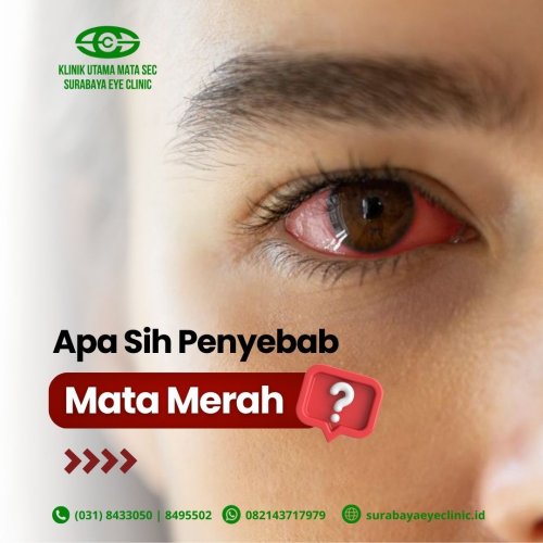PostPhoto