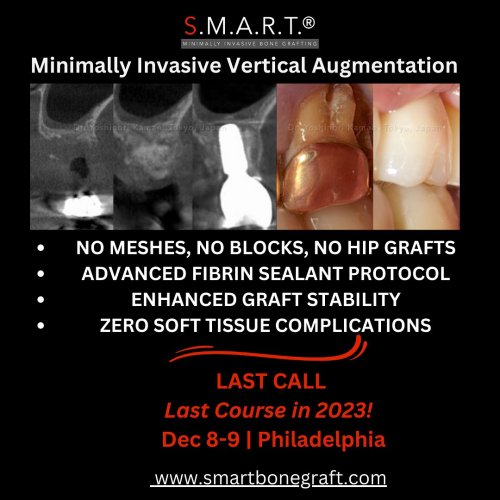 Photo post from smartbonegraft.