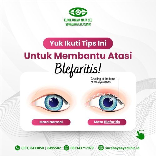 PostPhoto