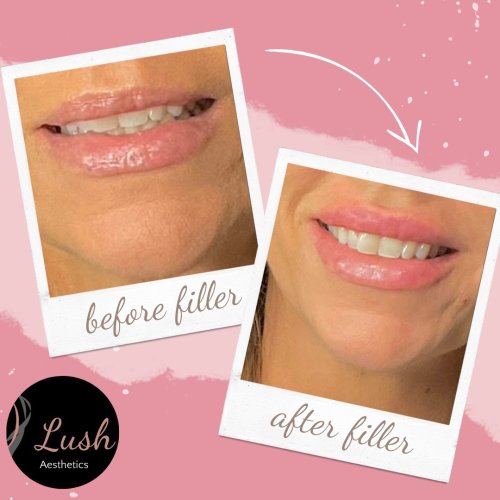 Photo post from lushaestheticsky.