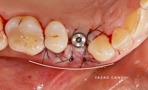 Carousel post from yazad.gandhi.