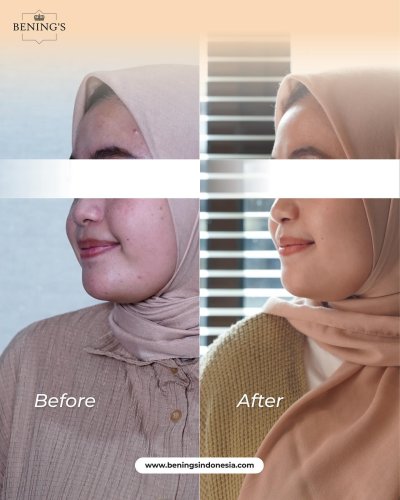 PostPhoto