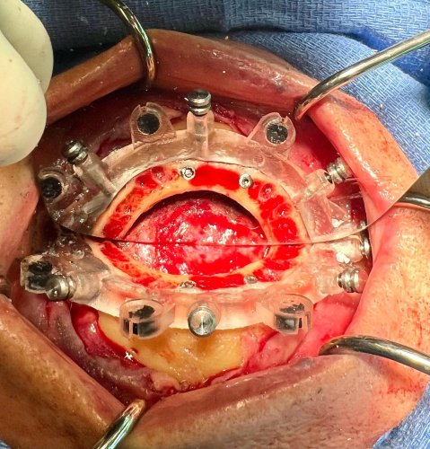 Photo post from toddengeldds.