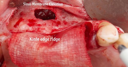 Carousel post from dr.sabaghazal.