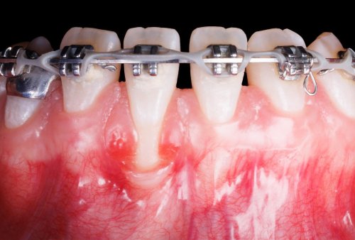 Carousel post from smilesurgeon.az.