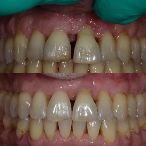 Carousel post from activeperio.