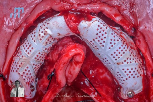 Carousel post from imperio_director.