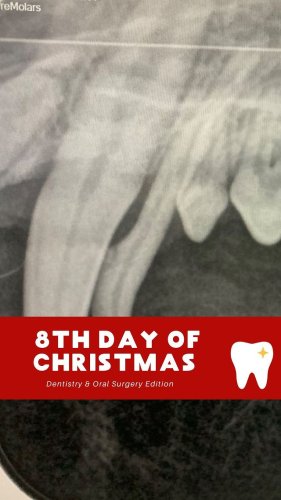 Video post from toothy.thomson.
