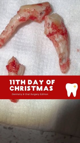 Video post from toothy.thomson.