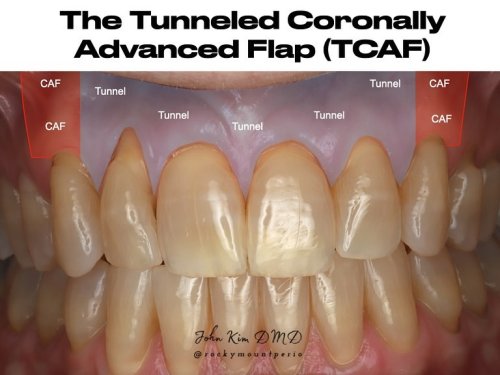 Carousel post from rockymountperio.