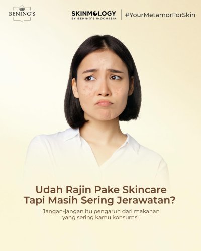 PostPhoto