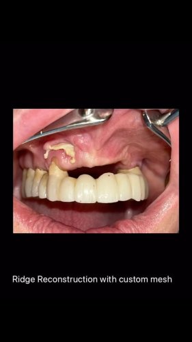 Video post from nscofs.