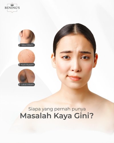 PostPhoto