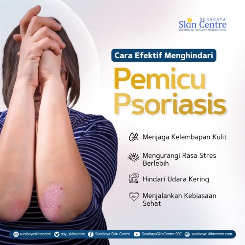 PostPhoto