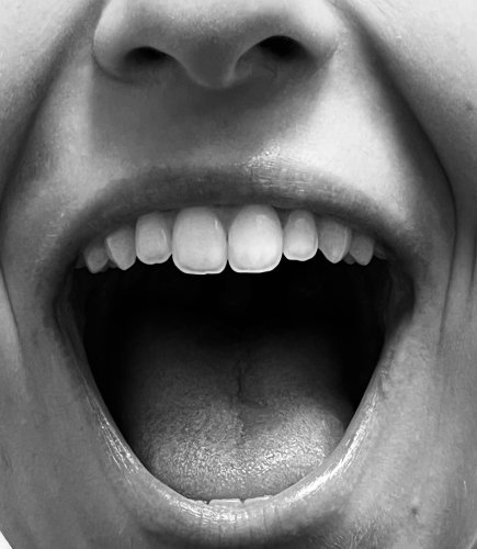 Photo post from trilliumdental.