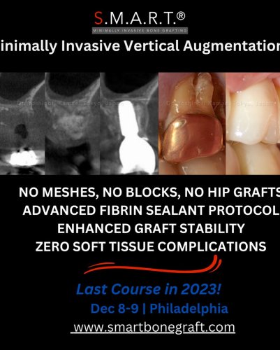 Photo post from smartbonegraft.