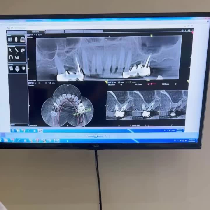 Carousel post from dr.andrespriotti.