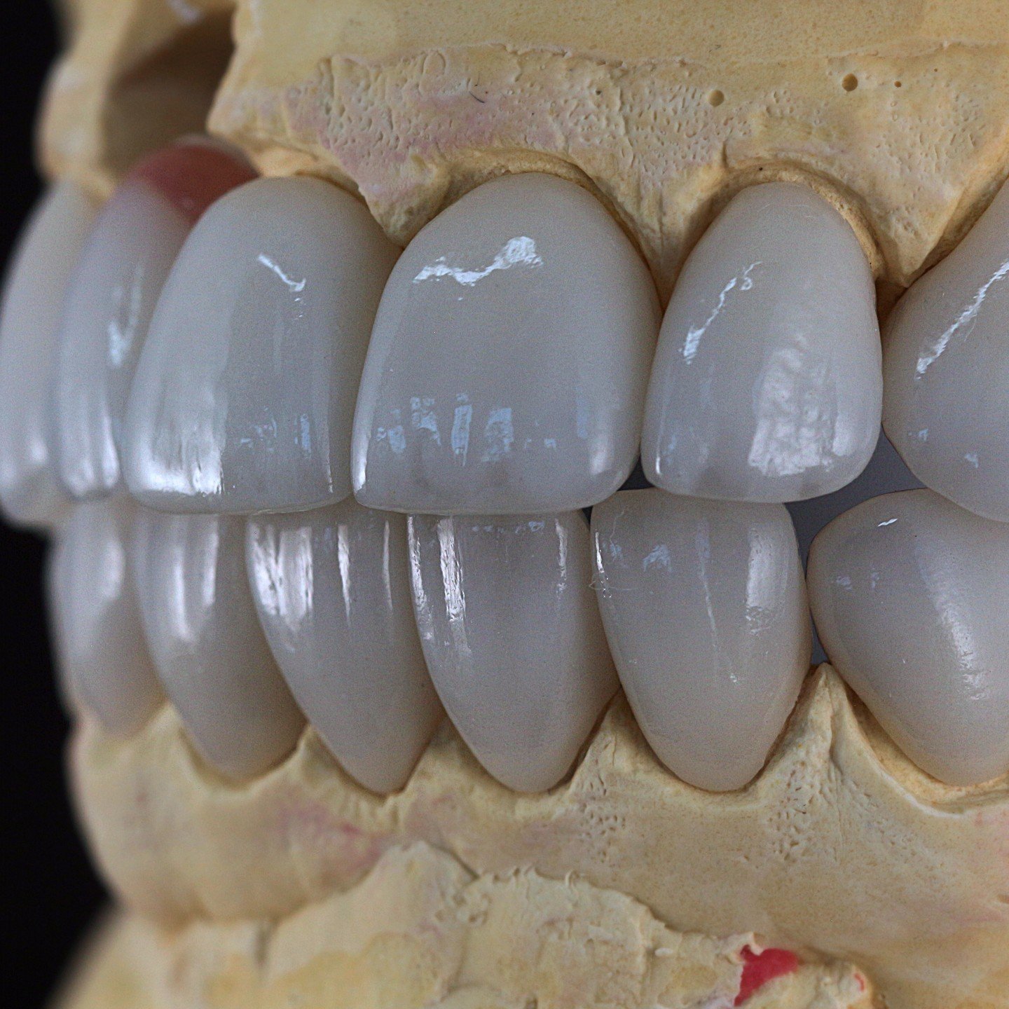 implantologie - implanturi dentare de la smilemed
