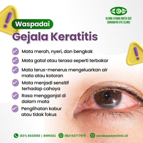 PostPhoto