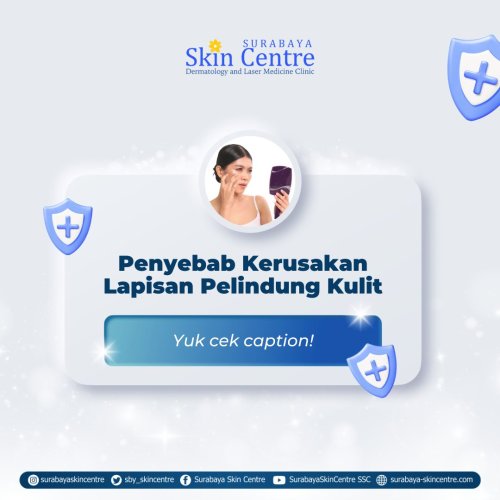 PostPhoto