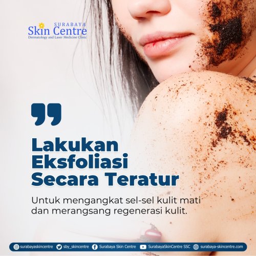 PostPhoto