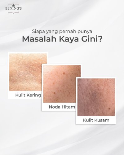 PostPhoto