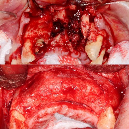 Carousel post from thefaceguys.