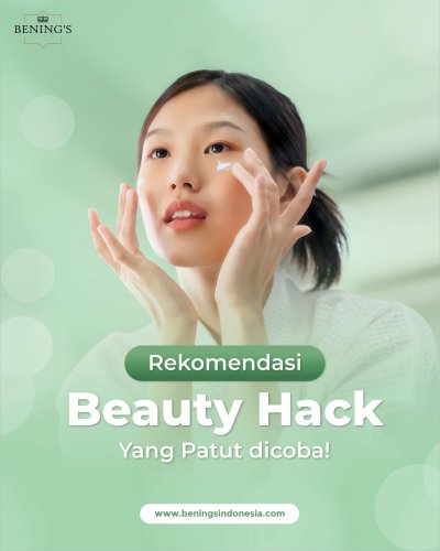PostPhoto