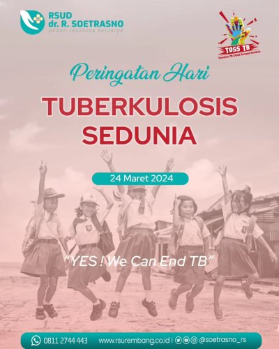 Photo post from soetrasno_rs.