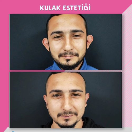 PostPhoto