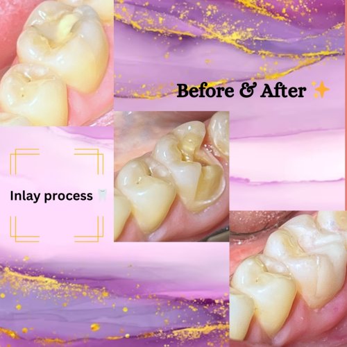 Photo post from trilliumdental.