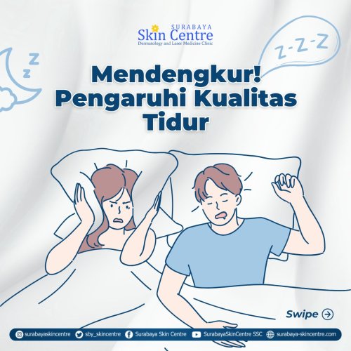 PostPhoto