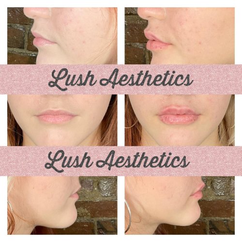 Photo post from lushaestheticsky.