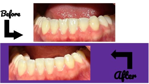 Photo post from trilliumdental.