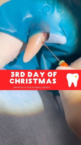 Video post from toothy.thomson.