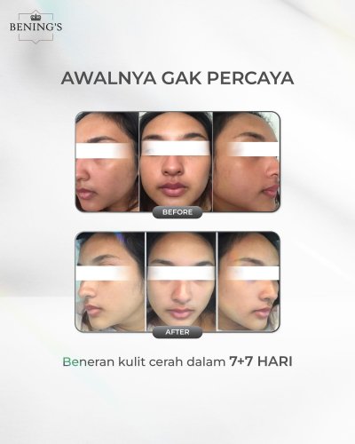 PostPhoto