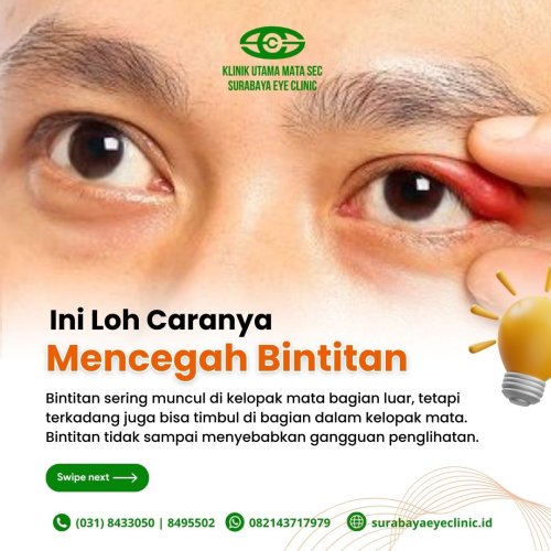 PostPhoto
