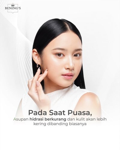 PostPhoto