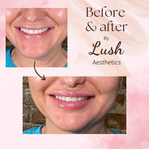 Photo post from lushaestheticsky.