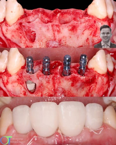 Carousel post from dr.owentrinh.