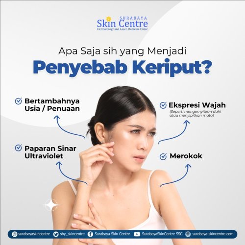 PostPhoto
